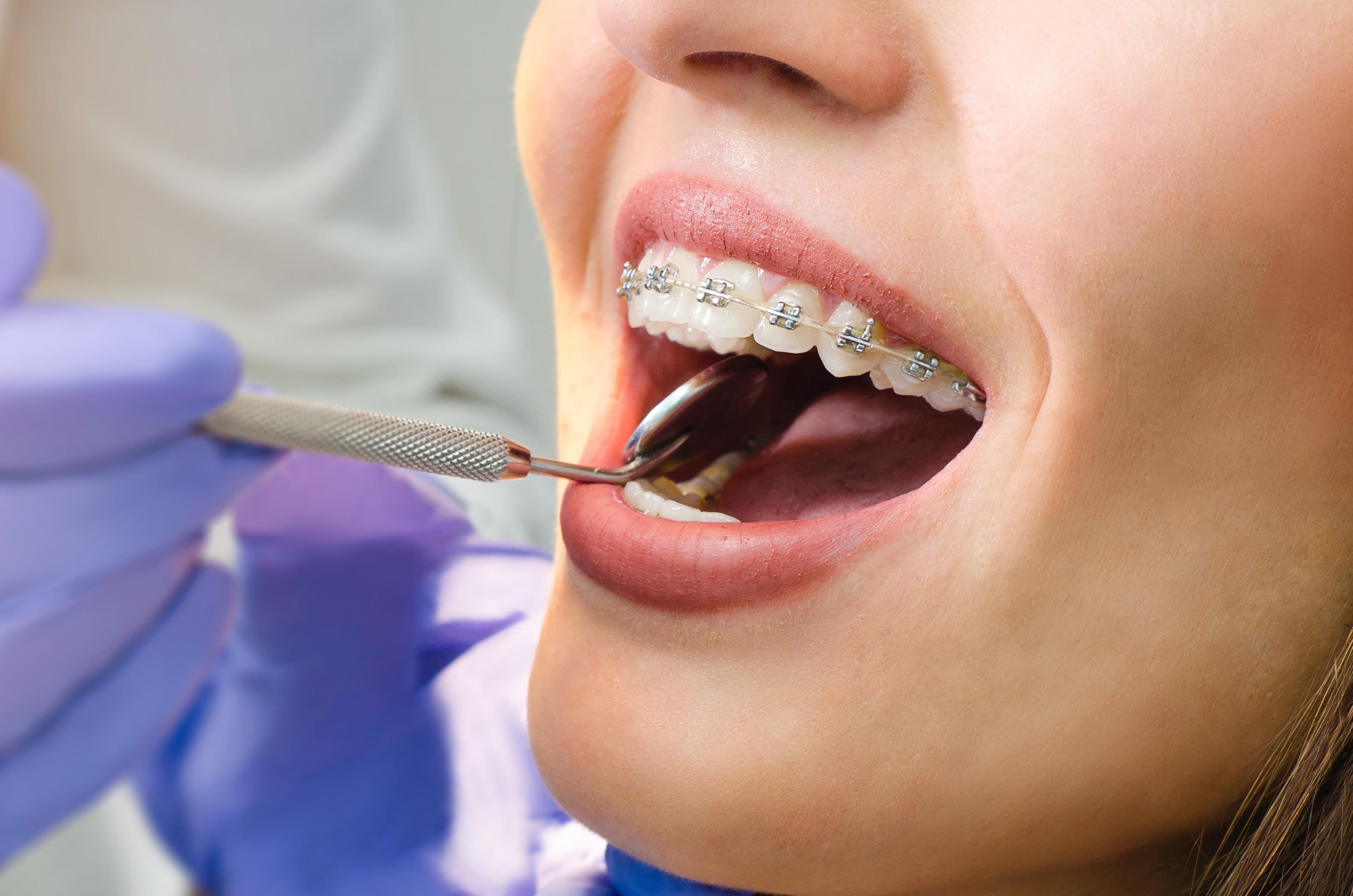 Orthodontics